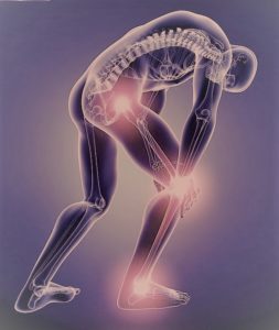 sciatica lombosciatalgia sciatalgia dolore osteopatia sebastian guzzetti