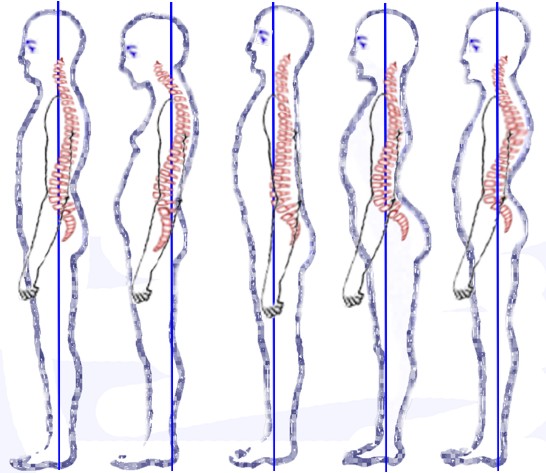 cervicale postura dolore collo male cervicalgia