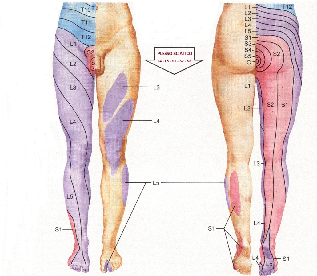 sciatica osteopata bergamo sebastian guzzetti dolore