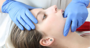 postura e denti
