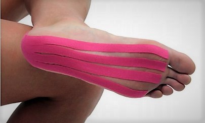 KINESIO TAPE