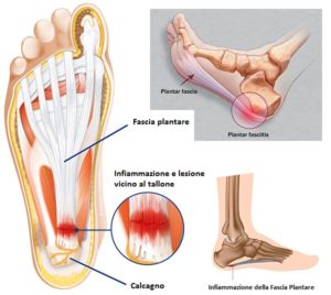 dolori ai piedi