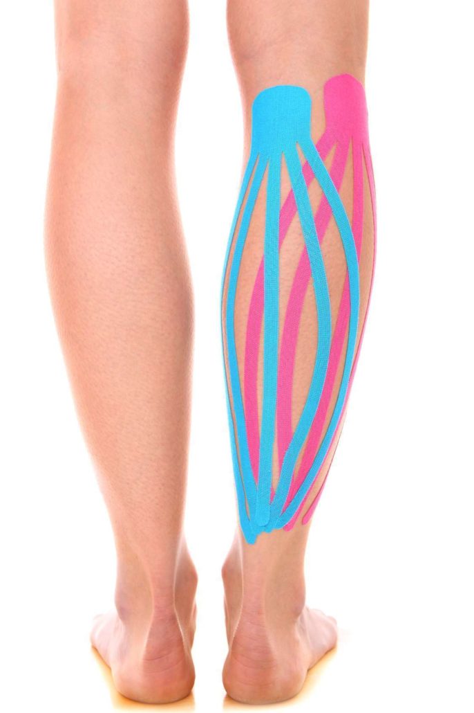 kinesio taping