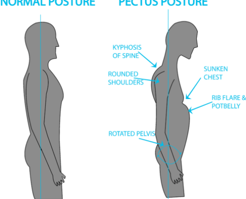 come migliorare la postura