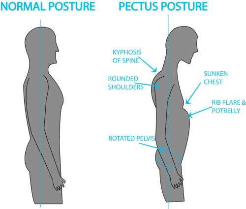 come migliorare la postura
