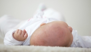 Come curare la testa piatta nei neonati
