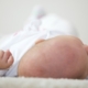 Come curare la testa piatta nei neonati