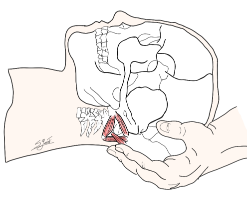 Nevralgia di Arnold e osteopatia